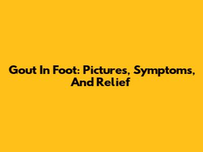 Gout In Foot: Pictures, Symptoms, And Relief